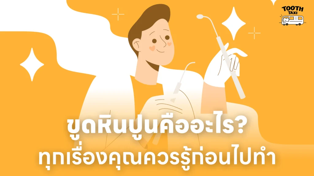 ขูดหินปูนคืออะไร? ทุกเรื่องที่คุณควรรู้ก่อนไปทำ