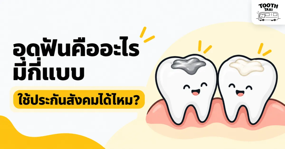 อุดฟันและสิทธิทำฟันประกันสังคม 2026