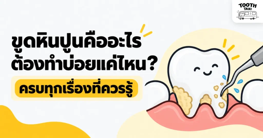 ขูดหินปูนคืออะไร ต้องทำบ่อยแค่ไหน? ครบทุกเรื่องที่ควรรู้