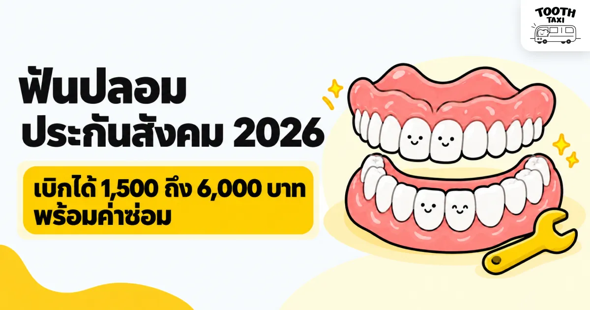 ฟันปลอมประกันสังคม 2026 วงเงิน 1,500 ถึง 6,000 บาท พร้อมค่าซ่อม