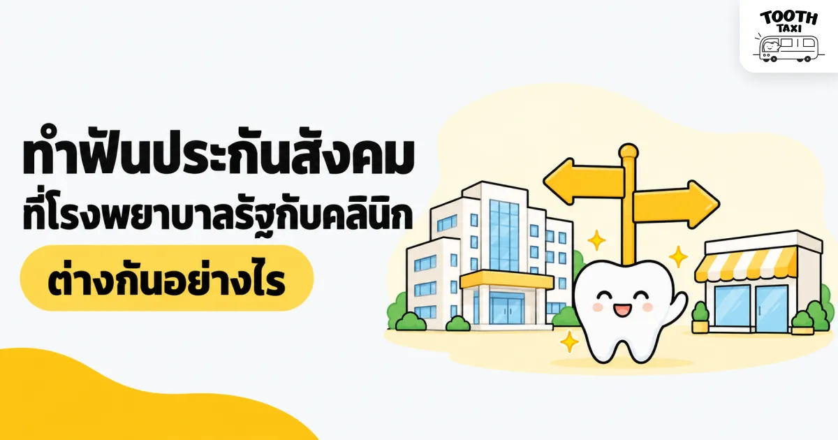 เปรียบเทียบสิทธิทำฟันประกันสังคมที่โรงพยาบาลรัฐกับคลินิกเอกชน