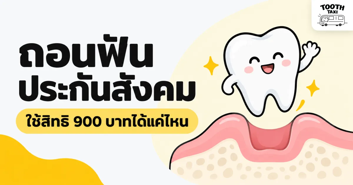 ถอนฟันประกันสังคมและวงเงินทำฟันพื้นฐาน 900 บาทต่อปี