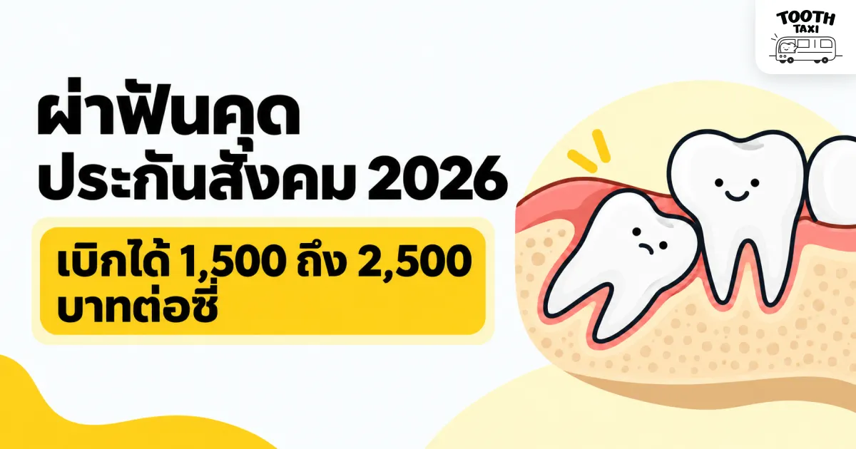 ผ่าฟันคุดประกันสังคม 2026 วงเงินแยก 1,500 ถึง 2,500 บาทต่อซี่ Tooth Taxi
